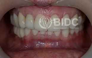 Periodontic Dentistry